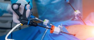 Endoscopy-on-a-Budget