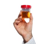 Dark Yellow Urine: Causes, Treatment, & How to Prevent?
