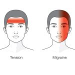 Types of Headaches