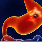 best gastroenterology surgeon in hyderabad
