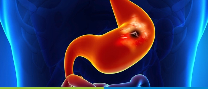 best gastroenterology surgeon in hyderabad