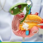 pancreas doctor in hyderabad
