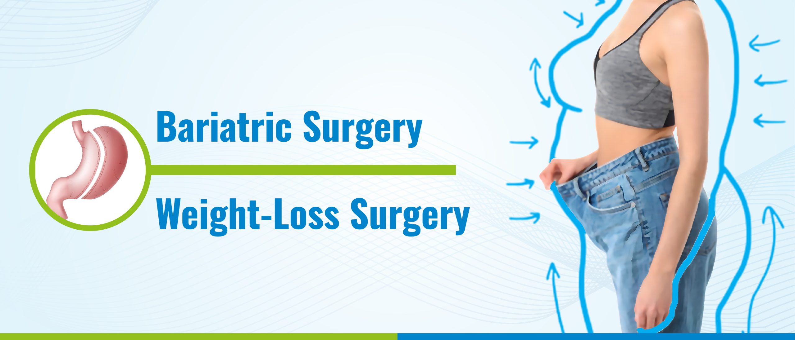 bariatric surgery in hyderabad
