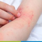 best skin specialist in kukatpally